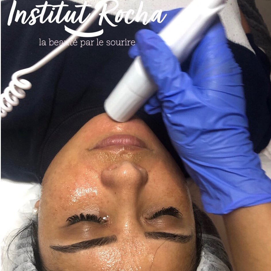 Radiofréquence Radiofréquence